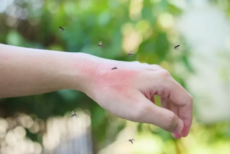 Aumentan los casos de encefalitis equina en la provincia de Buenos Aires