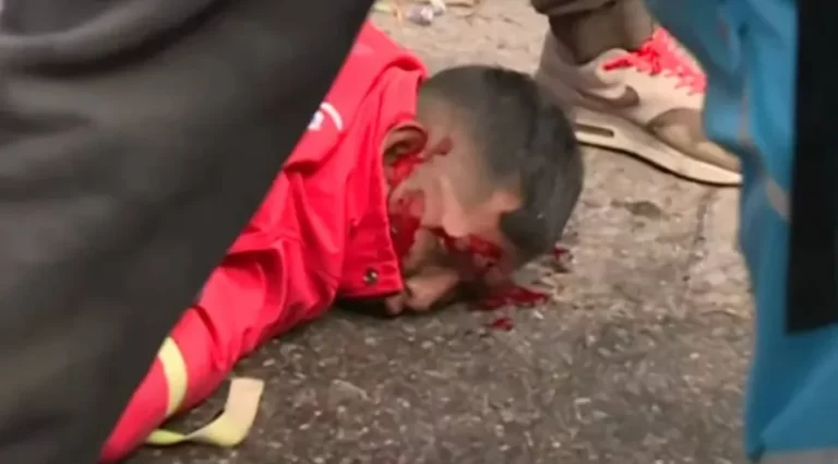 Brutal represión durante una protesta por el hambre